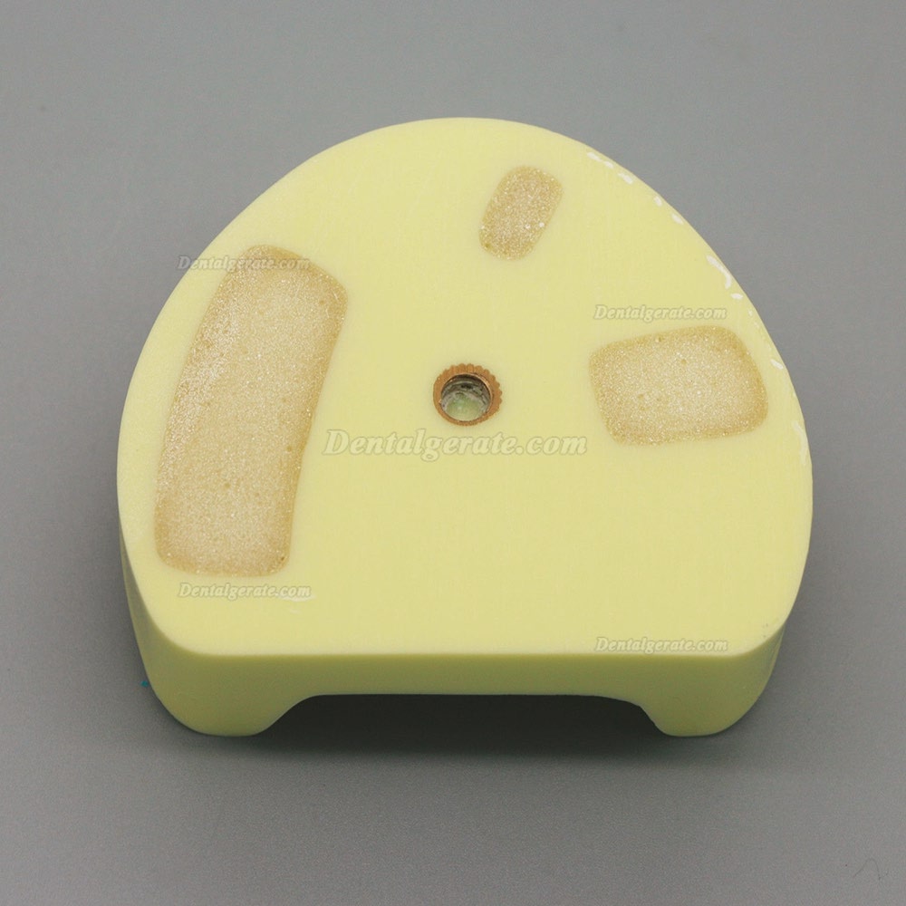 Dental Model # 2004 01 - Unterkieferimplantat-&Uuml;bungsmodell mit Gingiva